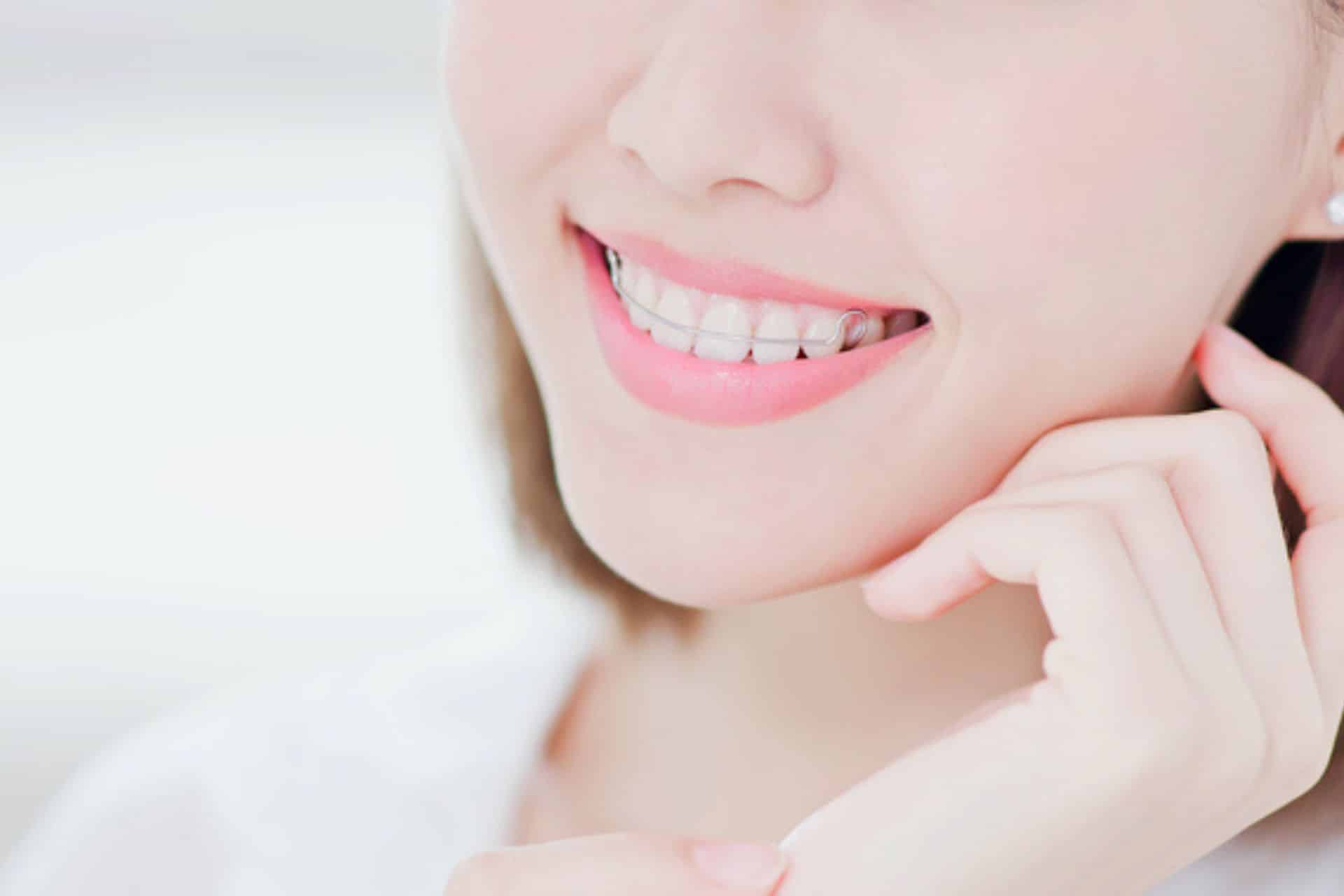 What Happens After Braces Come Off? Advanced Orthodontics in Bellevue, WA