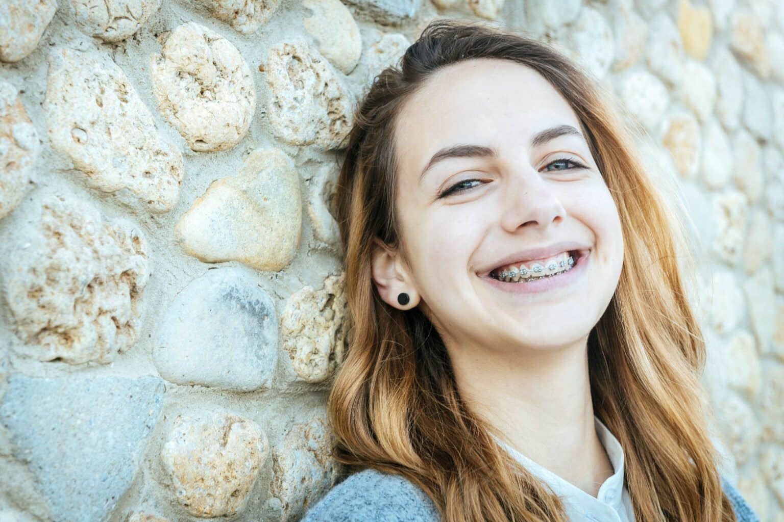 How Can Braces Patients Prevent White Spots on Teeth? Advanced Orthodontics in Bellevue, WA